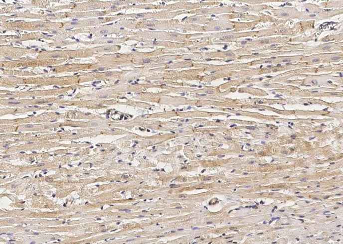 Anti-Rat DSC2 Antibody [B524]