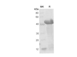 SDS-PAGE analysis of Mouse Ceacam1/BGP-1 proteins, 2 μg/lane of Recombinant Mouse Ceacam1/BGP-1 proteins was resolved with SDS-PAGE under reducing conditions, showing bands at 40-48 kDa.