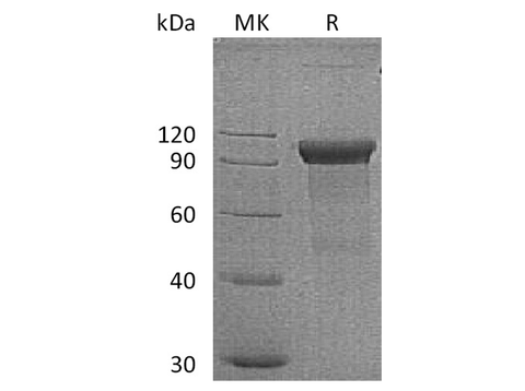 Recombinant Human ROR1 Protein (Fc Tag) - ABMIUM