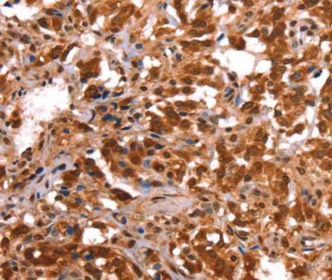 Anti-Human ESRRB Antibody