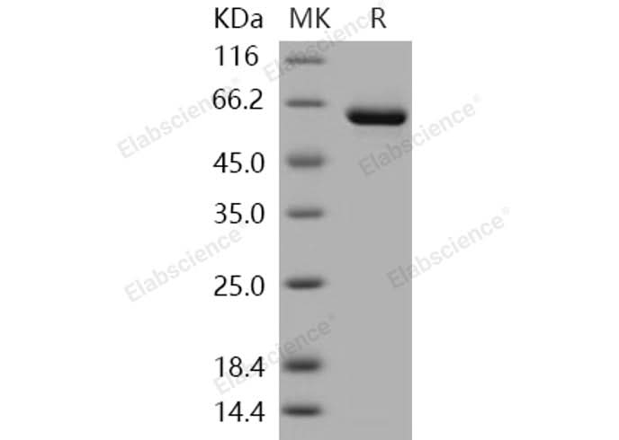 Recombinant Human USP7/HAUSP Protein (aa 208-560, His & GST Tag) - ABMIUM