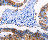 Anti-Human/Mouse/Rat EPCAM Antibody - ABMIUM