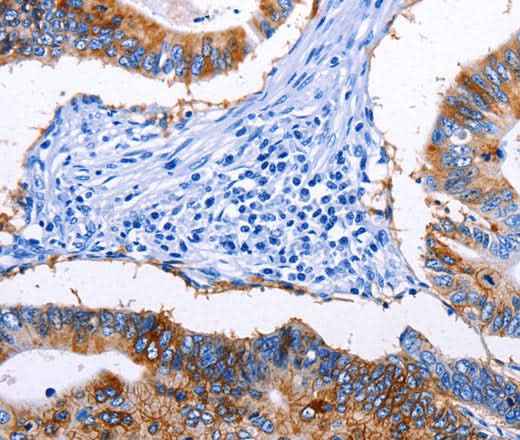 Anti-Human/Mouse/Rat EPCAM Antibody
