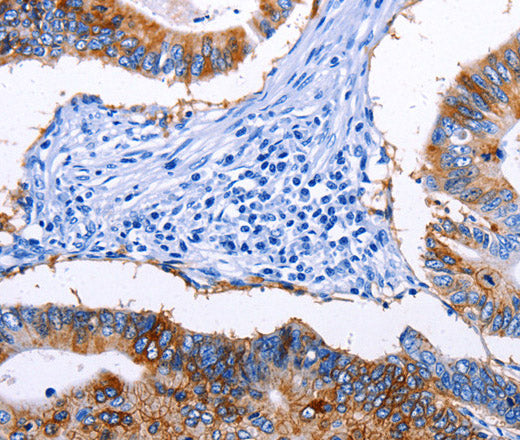Anti-Human/Mouse/Rat EPCAM Antibody - ABMIUM