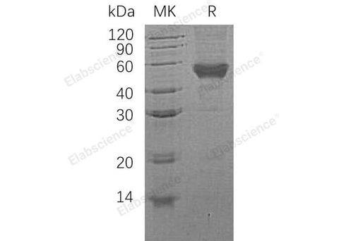 Recombinant Human CD14 Protein (His Tag) - ABMIUM
