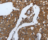 Anti-Human SLC34A2 Antibody - ABMIUM