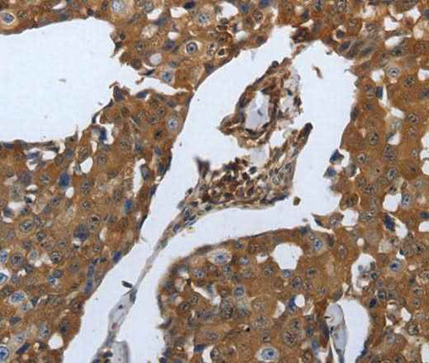 Anti-Human SLC34A2 Antibody