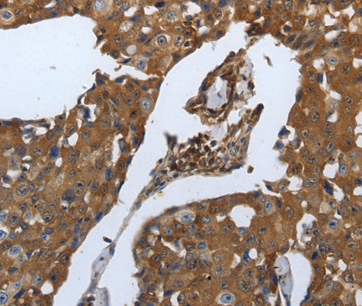 Anti-Human SLC34A2 Antibody - ABMIUM