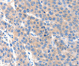 Anti-Human KLK2 Antibody - ABMIUM