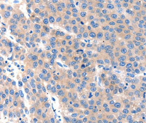 Anti-Human KLK2 Antibody - ABMIUM