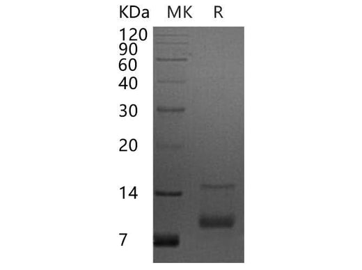 Recombinant Human CXCL7/NAP-2 Protein - ABMIUM