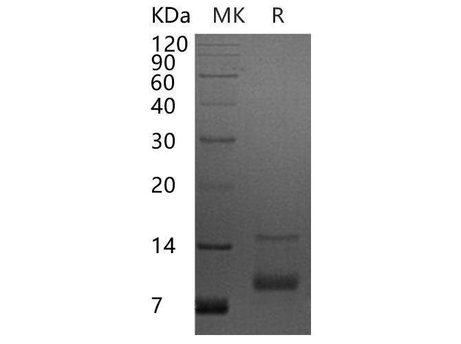 Recombinant Human CXCL7/NAP-2 Protein - ABMIUM