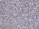 Immunohistochemistry of paraffin-embedded Human tonsil tissue using RIC3 Polyclonal Antibody at dilution of 1:90(×200)