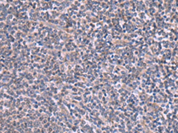 Immunohistochemistry of paraffin-embedded Human tonsil tissue using RIC3 Polyclonal Antibody at dilution of 1:90(×200)