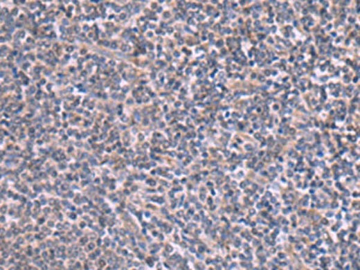 Immunohistochemistry of paraffin-embedded Human tonsil tissue using RIC3 Polyclonal Antibody at dilution of 1:90(×200)