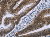 Anti-Human/Mouse/Rat HMGA1 Antibody - ABMIUM