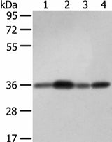 Anti-Human/Mouse/Rat STX12 Antibody - ABMIUM