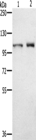 Anti-Human/Mouse/Rat ODF2 Antibody - ABMIUM