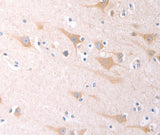 Anti-Human SCGB1A1 Antibody - ABMIUM