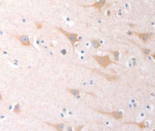 Anti-Human SCGB1A1 Antibody