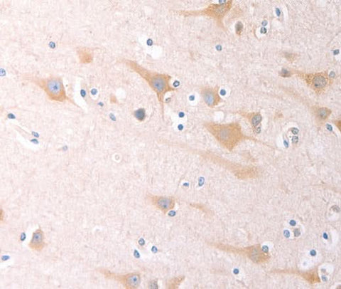 Anti-Human SCGB1A1 Antibody - ABMIUM