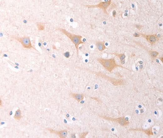 Anti-Human SCGB1A1 Antibody - ABMIUM