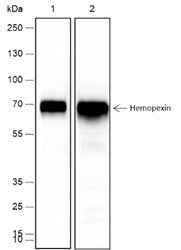 Anti-Human Hemopexin Antibody [A452] - ABMIUM