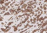 Anti-Human KRT7 Antibody [A896] - ABMIUM
