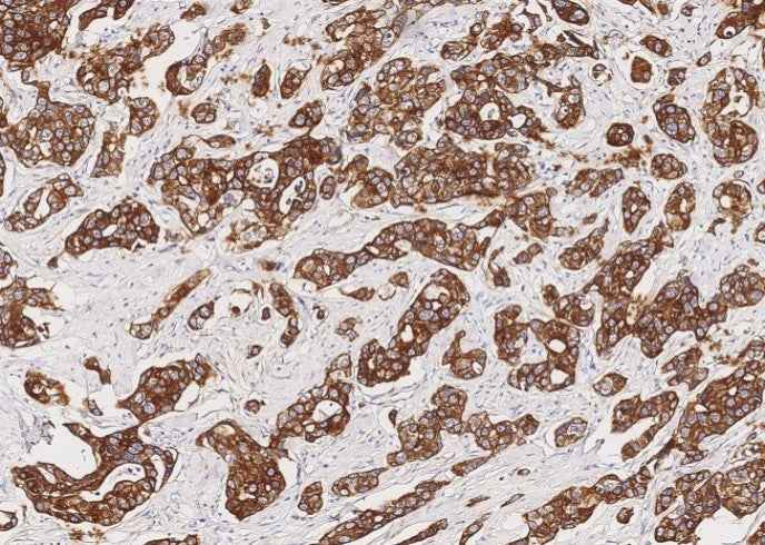 Anti-Human KRT7 Antibody [A896] - ABMIUM