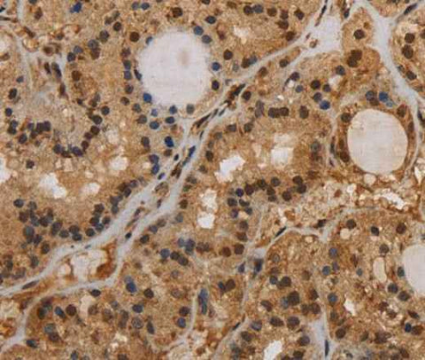 Anti-Human KCNN4 Antibody