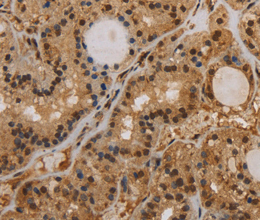 Anti-Human KCNN4 Antibody - ABMIUM