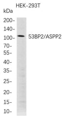 Anti-Human 53BP2 Antibody [B707]