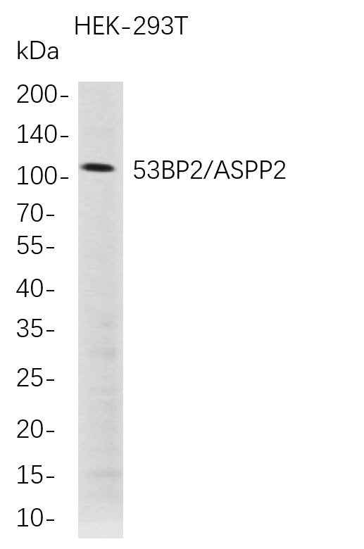 Anti-Human 53BP2 Antibody [B707] - ABMIUM