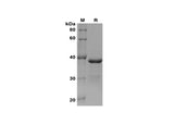 SDS-PAGE analysis of Human ABCG2 proteins, 2 μg/lane of Recombinant Human ABCG2 proteins was resolved with SDS-PAGE under reducing conditions, showing bands at 38 kDa.
