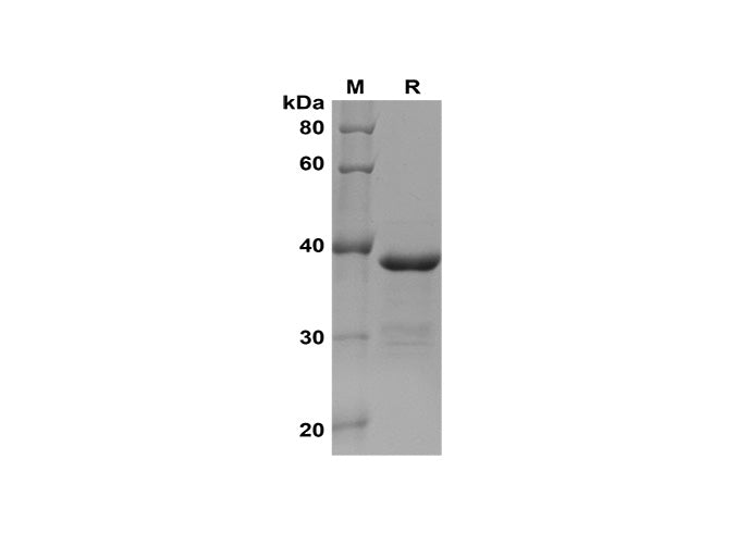 SDS-PAGE analysis of Human ABCG2 proteins, 2 μg/lane of Recombinant Human ABCG2 proteins was resolved with SDS-PAGE under reducing conditions, showing bands at 38 kDa.