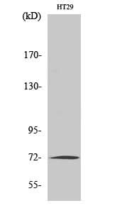 Western Blot analysis of HT-29 cells using MMP2 Polyclonal Antibody at dilution of 1:1000.