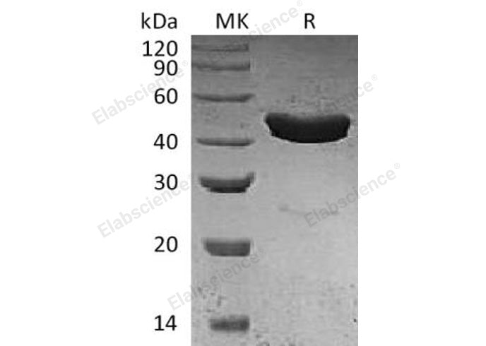 Recombinant Human SerpinB3/SCCA1 Protein (E.coli, His Tag) - ABMIUM