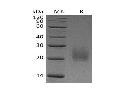 Recombinant Mouse CTLA4 Protein (His Tag) - ABMIUM
