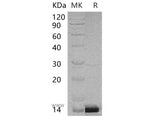Recombinant Human PCBD1 Protein (His Tag) - ABMIUM