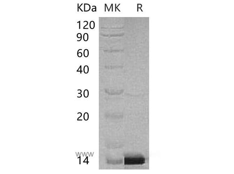 Recombinant Human PCBD1 Protein (His Tag) - ABMIUM