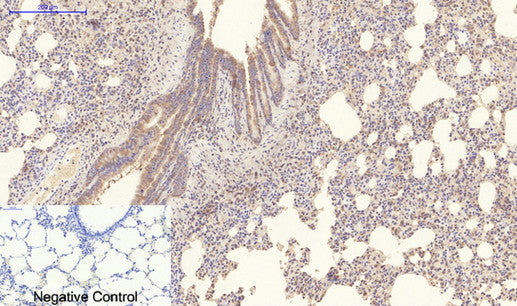 Immunohistochemistry of paraffin-embedded Rat lung tissue using COL4A1 Monoclonal Antibody at dilution of 1:200.