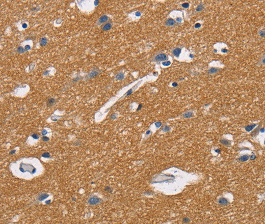 Anti-Human CD47 Antibody - ABMIUM