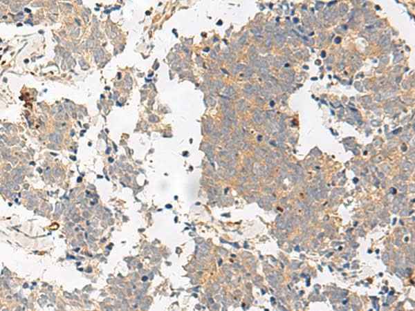 Anti-Human GPR153 Antibody