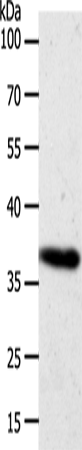Anti-Human AKR1B1 Antibody - ABMIUM