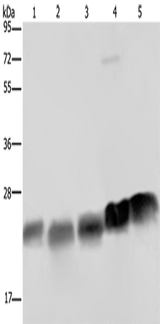 Anti-Human/Mouse NDUFS8 Antibody - ABMIUM