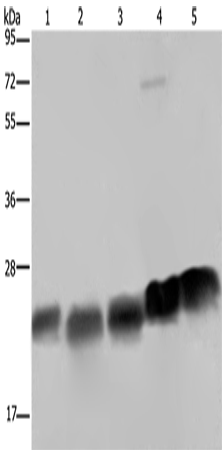 Anti-Human/Mouse NDUFS8 Antibody - ABMIUM