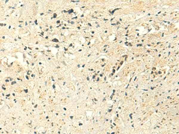 Anti-Human/Mouse MTHFS Antibody