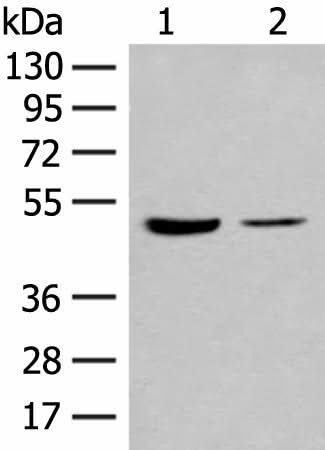 Anti-Human IL7R Antibody - ABMIUM