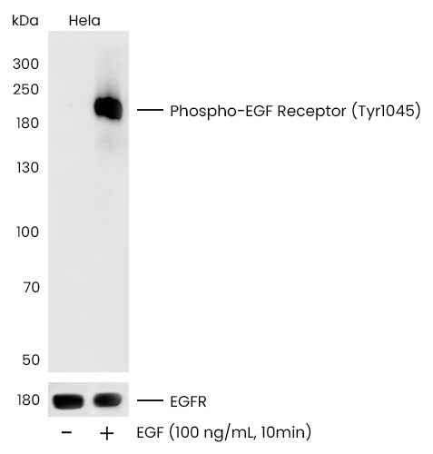 Anti-Human EGFR Antibody [A1120] - ABMIUM