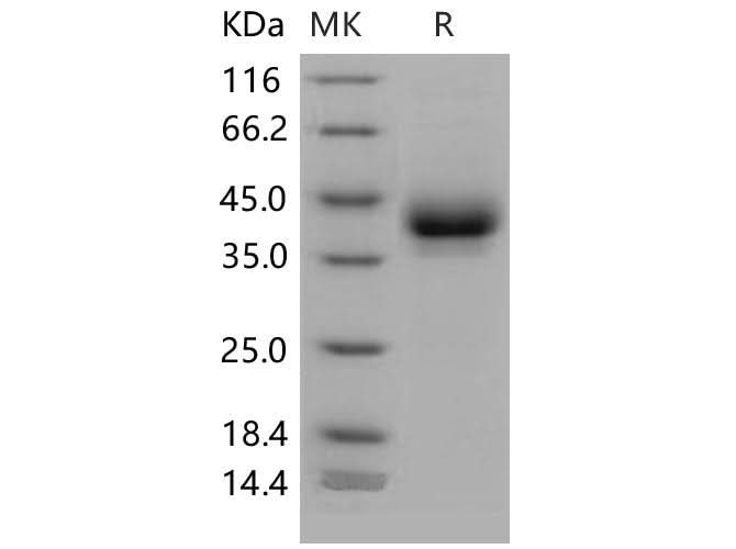 > 95 % as determined by reducing SDS-PAGE.